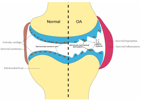 機(jī)械信號轉(zhuǎn)導(dǎo)：流體剪切力在骨關(guān)節(jié)炎發(fā)展中的關(guān)鍵作用